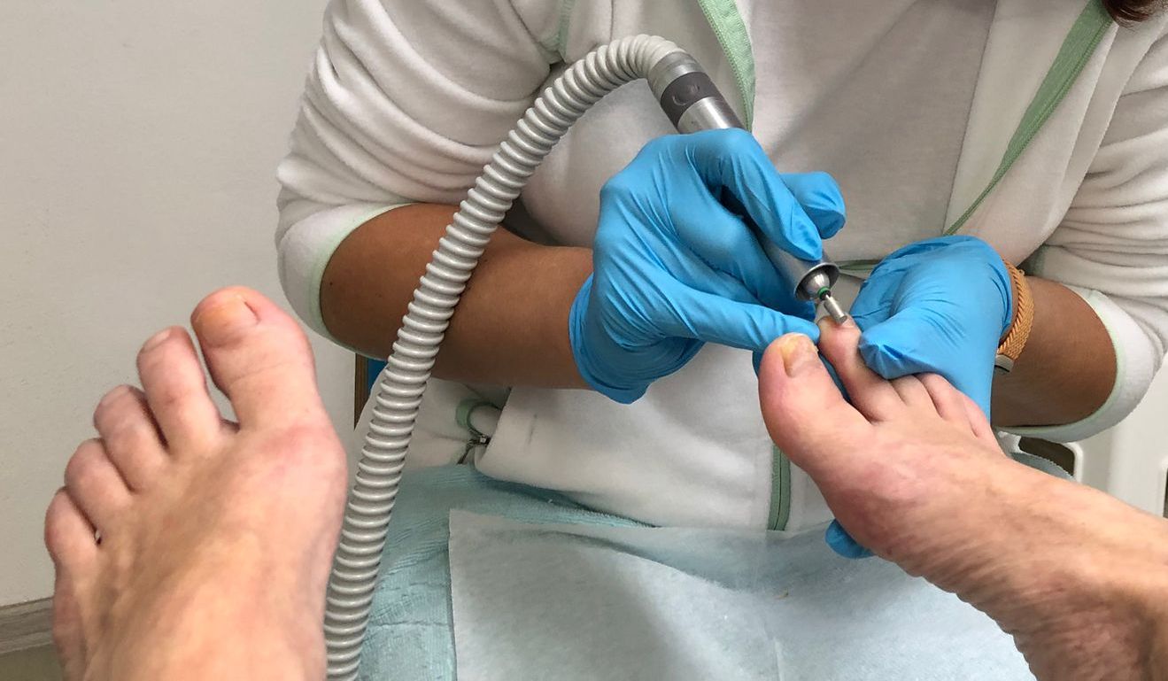 Přístrojová pedikúra