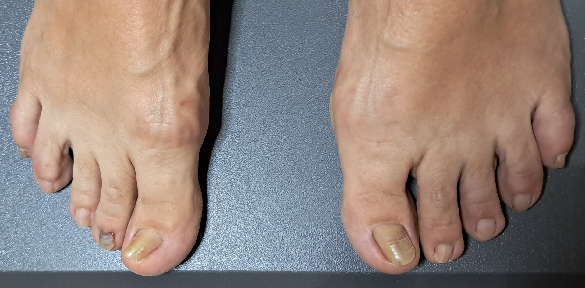 Nehty po úpravách.