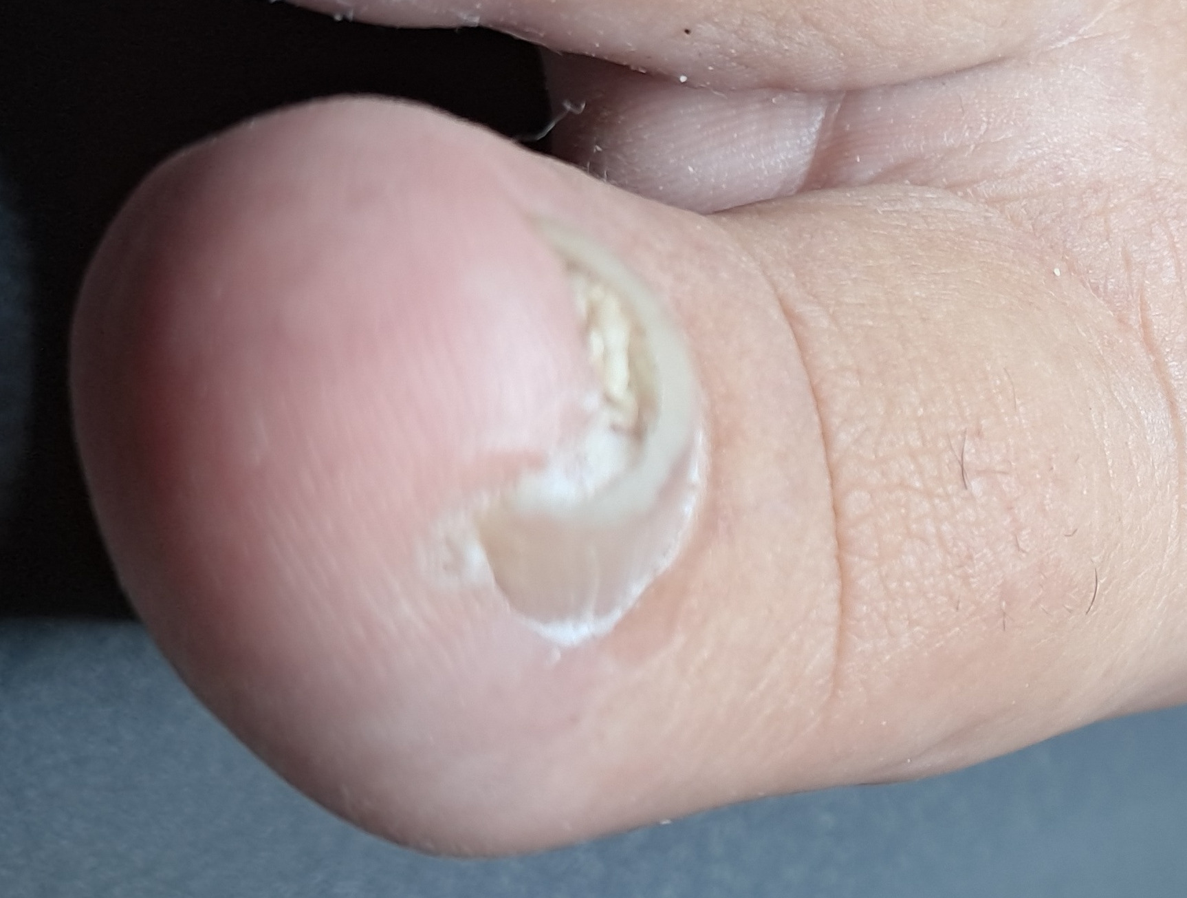 Levý nehet před úpravou.